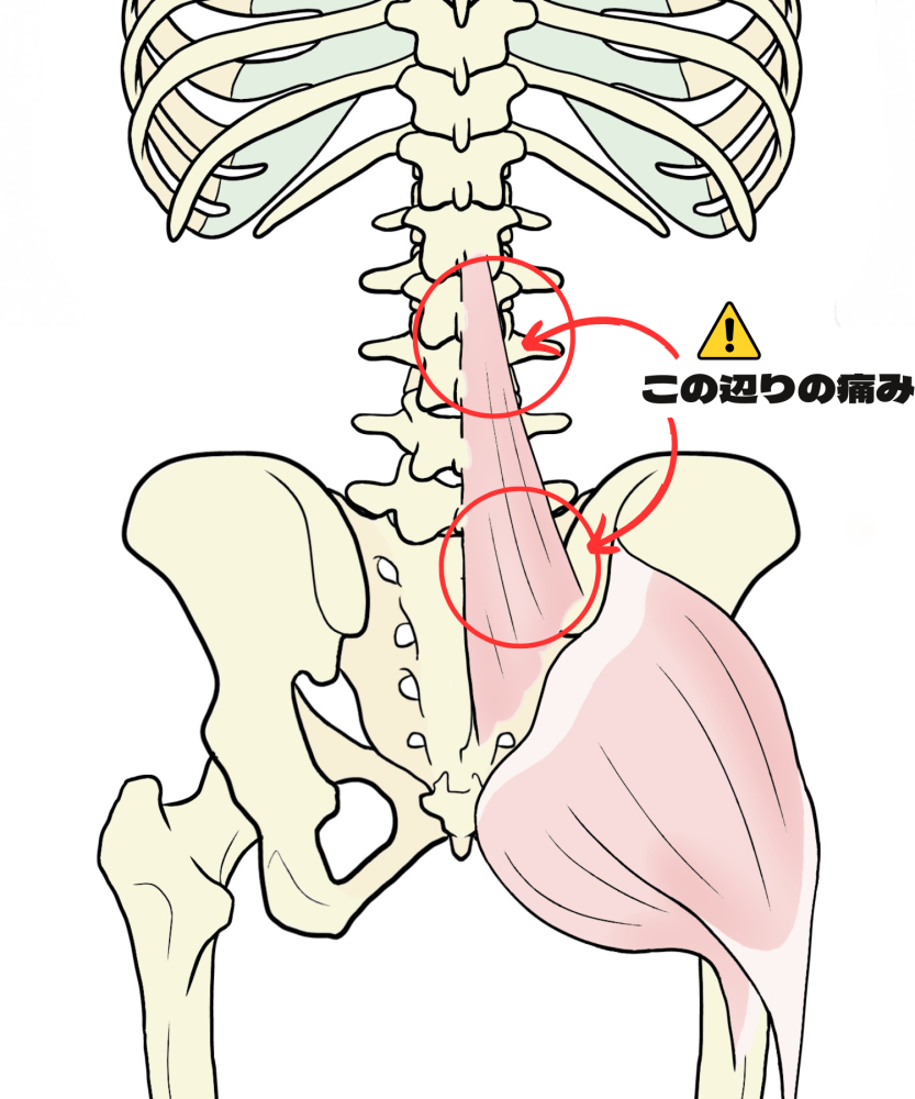 福島市で『多裂筋が原因の腰痛』でお悩みでしたらヒロ整体院へ